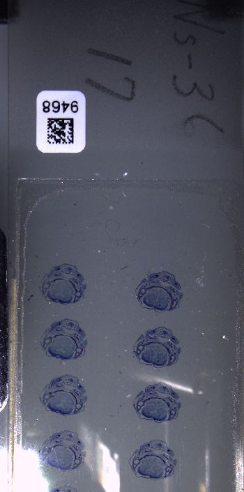 Media type: image; Special Collections 3102   shows specimen_part histological serial section;  Description: Whole slide scan, SC-3102, slide 17;